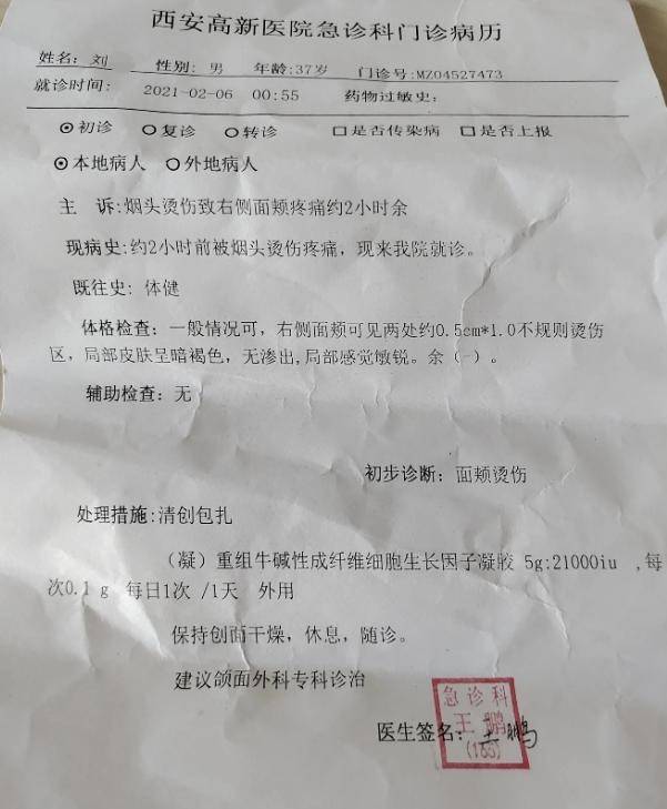 西安警方通报职员遭高管烟头烫脸